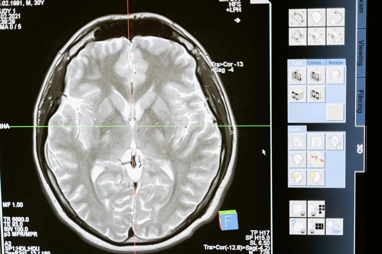 Everything we know about the 5-HT2A (serotonin) receptor